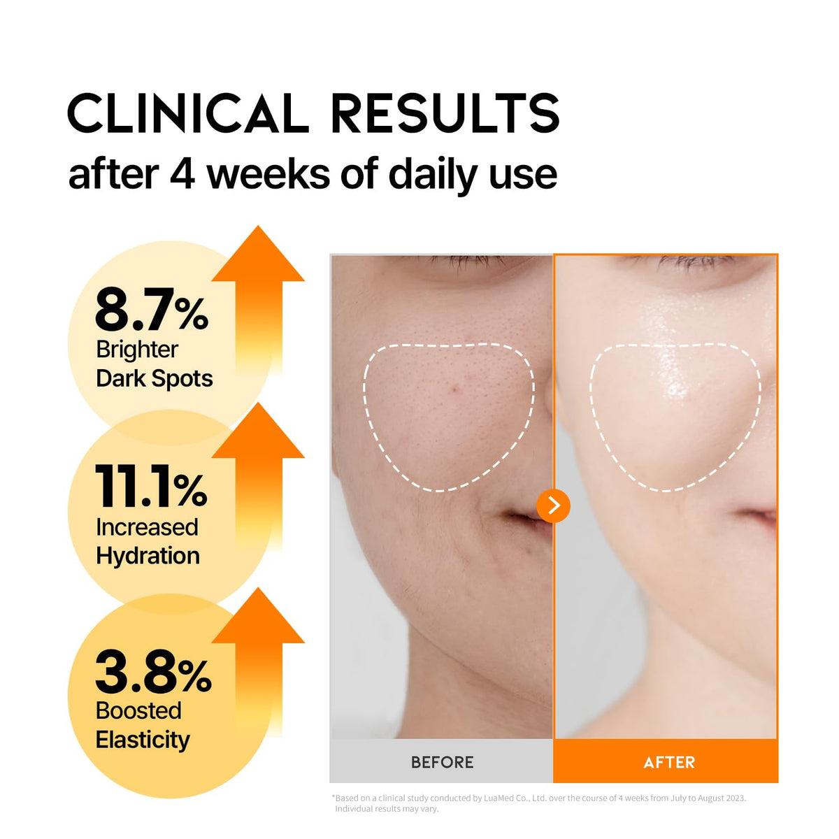 Korean Vitamin C Serum for Brightening and Glowing Skin with Ascorbic Acid & Vitamin Tree Water, Facial Serum 1.69 Fl Oz